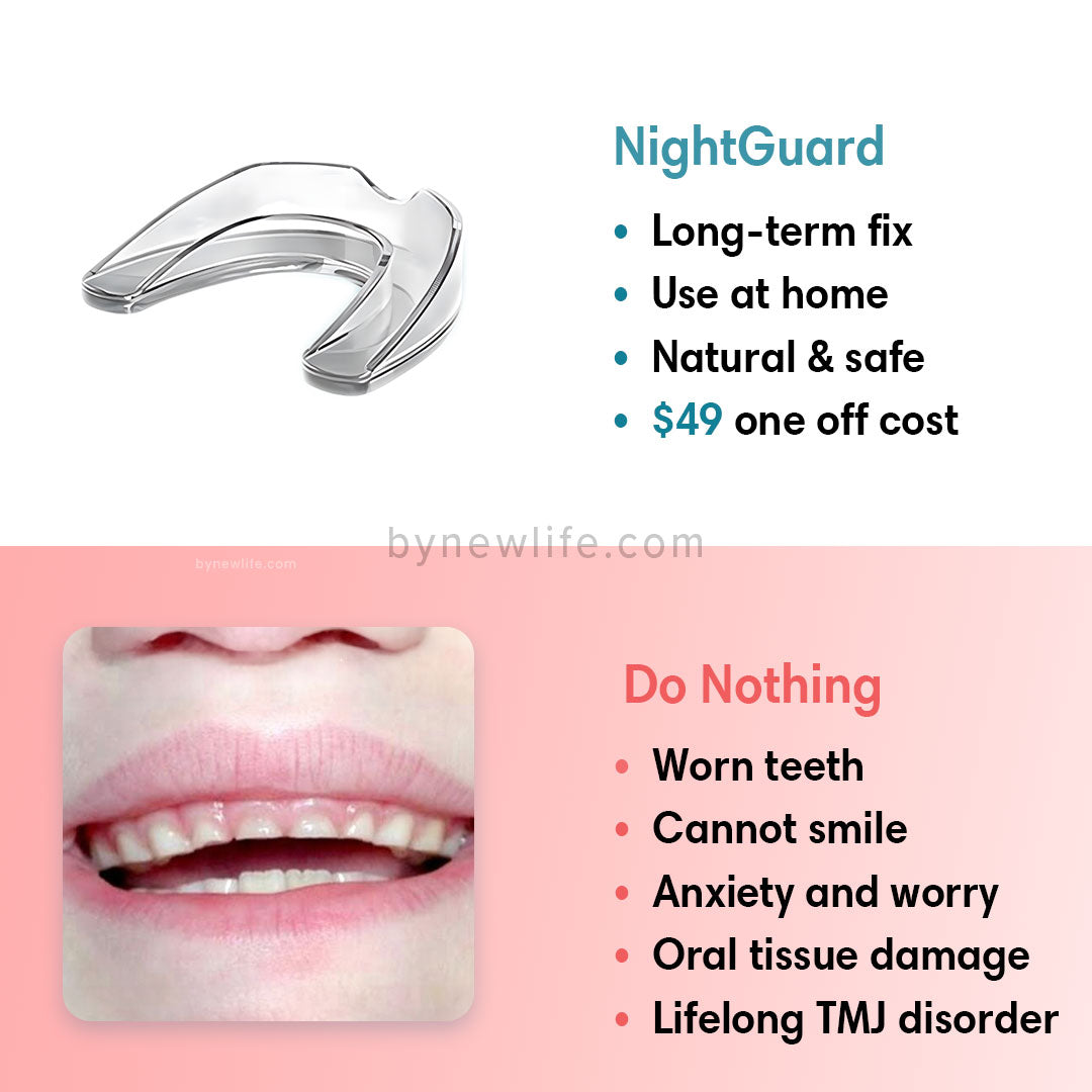 NightGuard - Bruxism Relief Mouthpiece